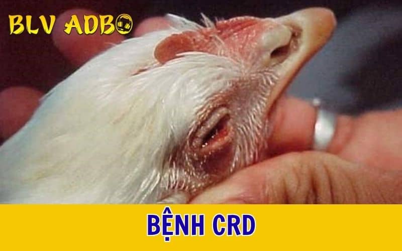 Bệnh CRD