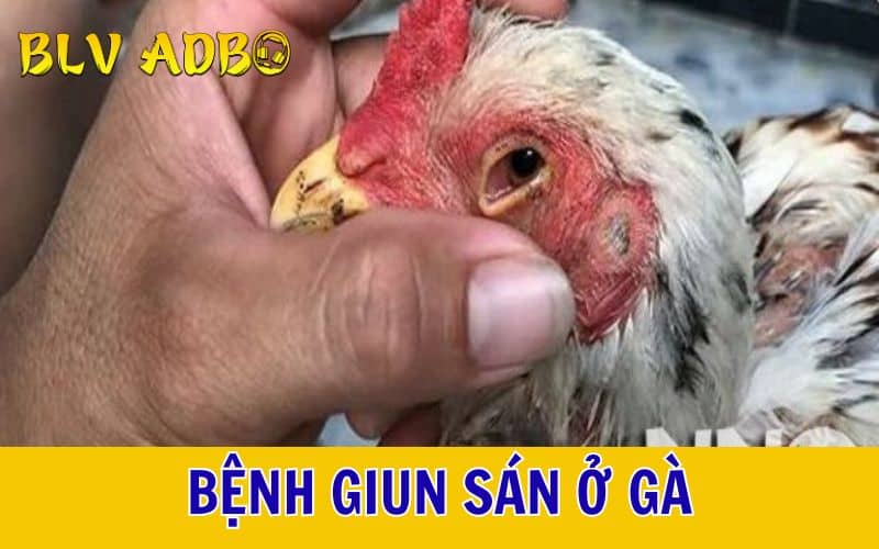 Bệnh giun sán